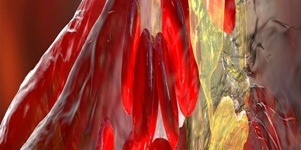 Cardiovascular Atherosclerosis 2026: Prediction, Prevention and Management CME Course-San Diego, CA promotional image